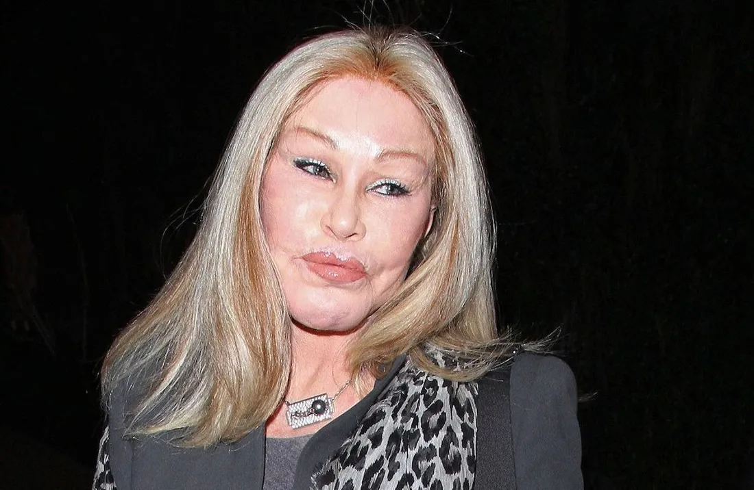 Adieu à Jocelyne Wildenstein, la 'femme chat' de la jet-set