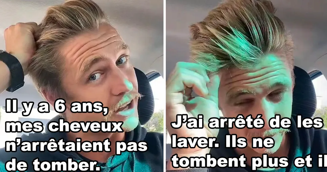 Pendant 6 ans un TikTokeur ne s'est pas laver les cheveux, ça aurait réglé son problème capillaire !