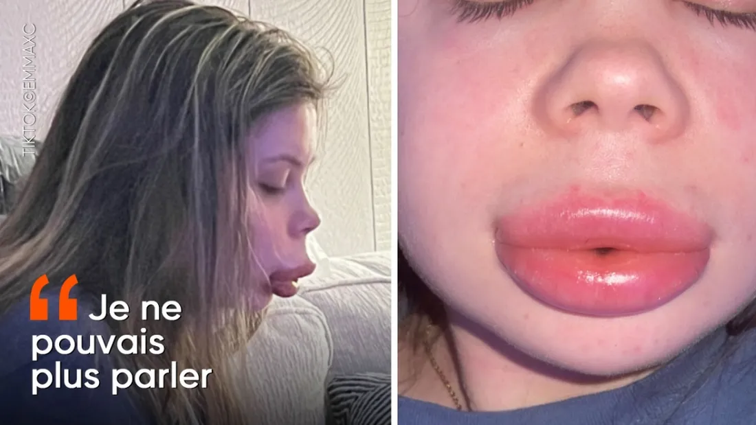 2 sœurs on fait plus de 600 personnes en injectant du botox illégalement ! 