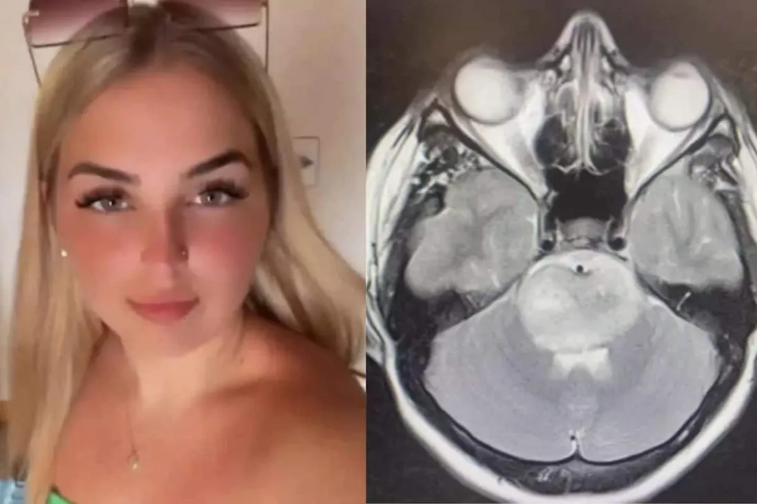 Elle pensait que c'était une gueule de bois, mais la réalité est beaucoup plus tragique