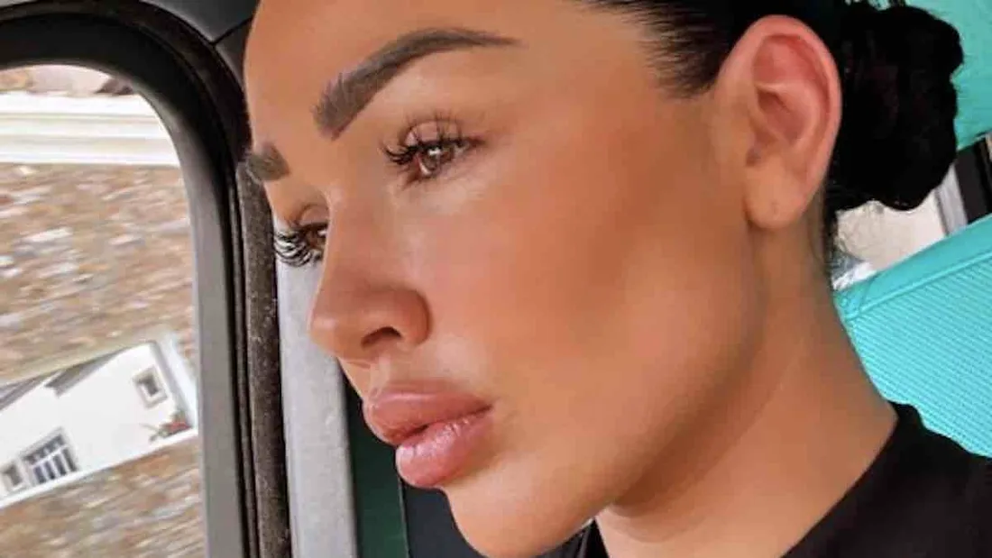 Une nouvelle chirurgie au visage pour Jazz ? Elle répond