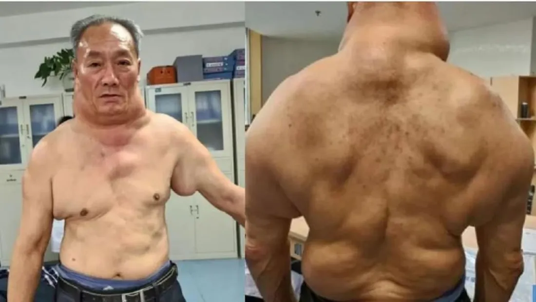 Voilà le résultat d’1 litre d’alcool par jour depuis l’âge des 13 sur un homme. 