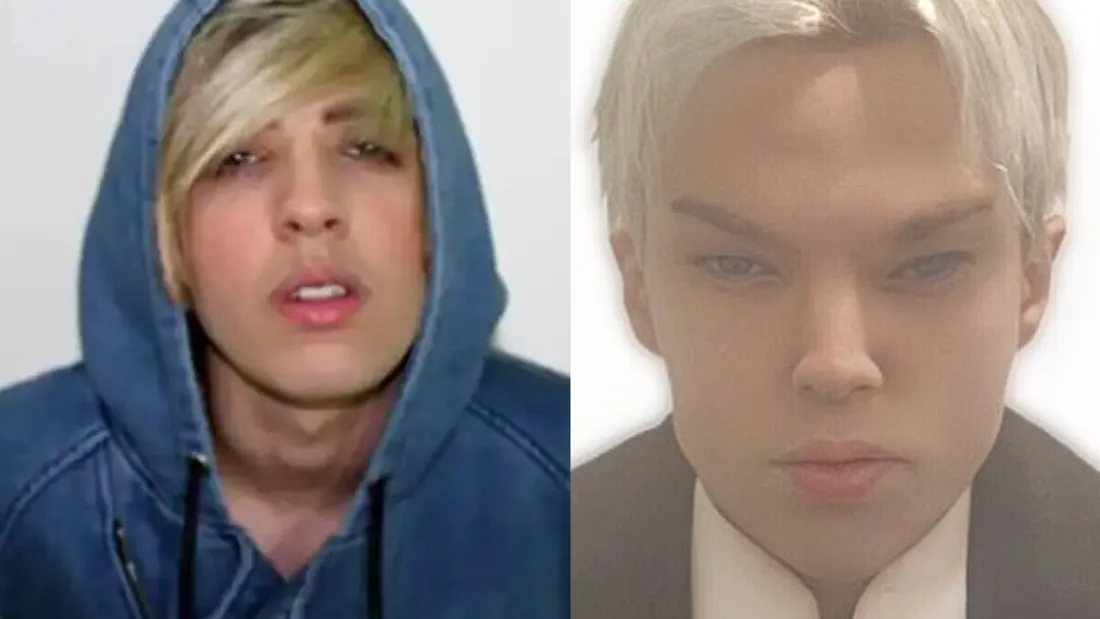 Mort d'un acteur de 22 ans après l'ultime chirurgie pour ressembler à son chanteur préféré !