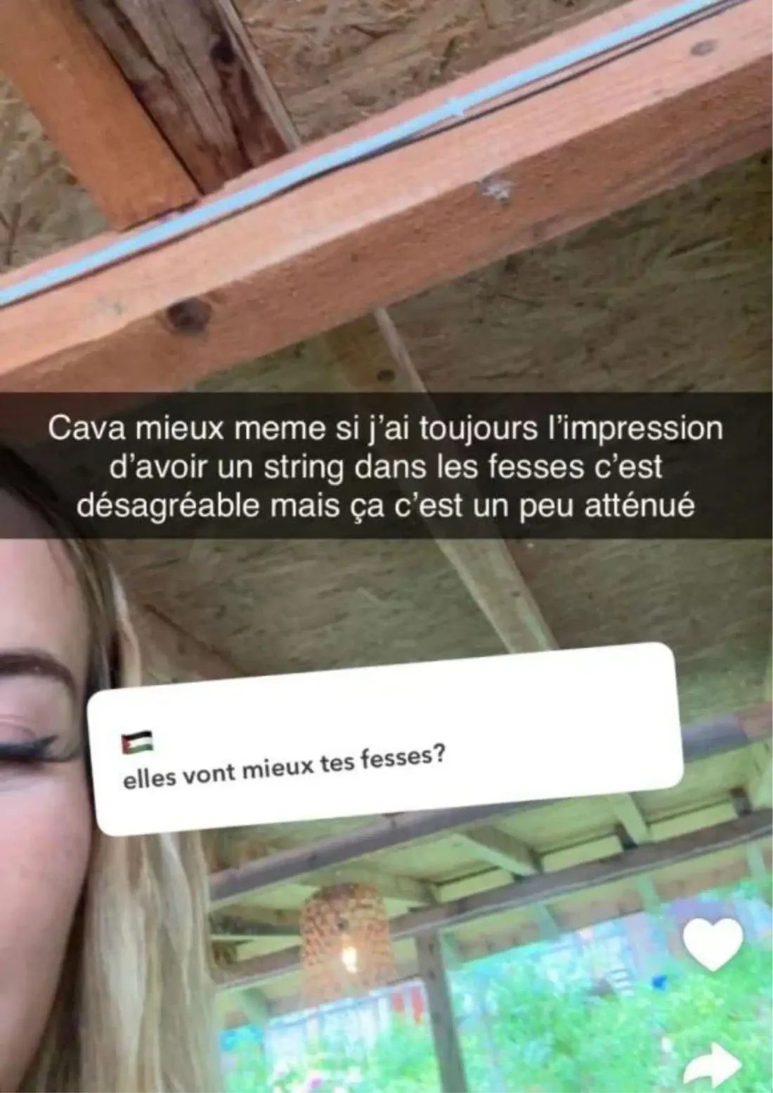 Polska déconseille fortement les implants aux fesses et explique pourquoi