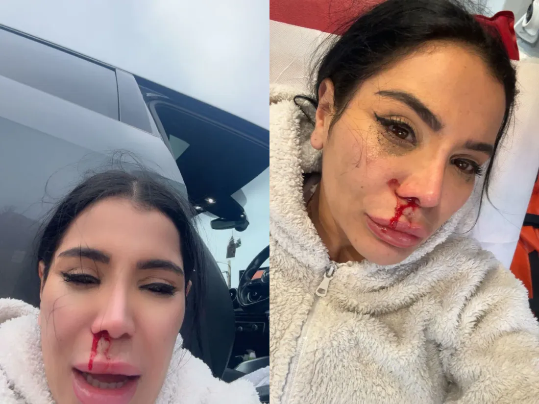 L’influenceuse Soraya Riffy porte plainte après avoir été agressée