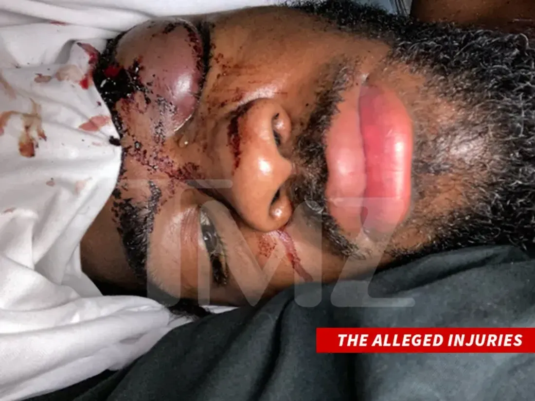 Twin Hector Violence conjugale