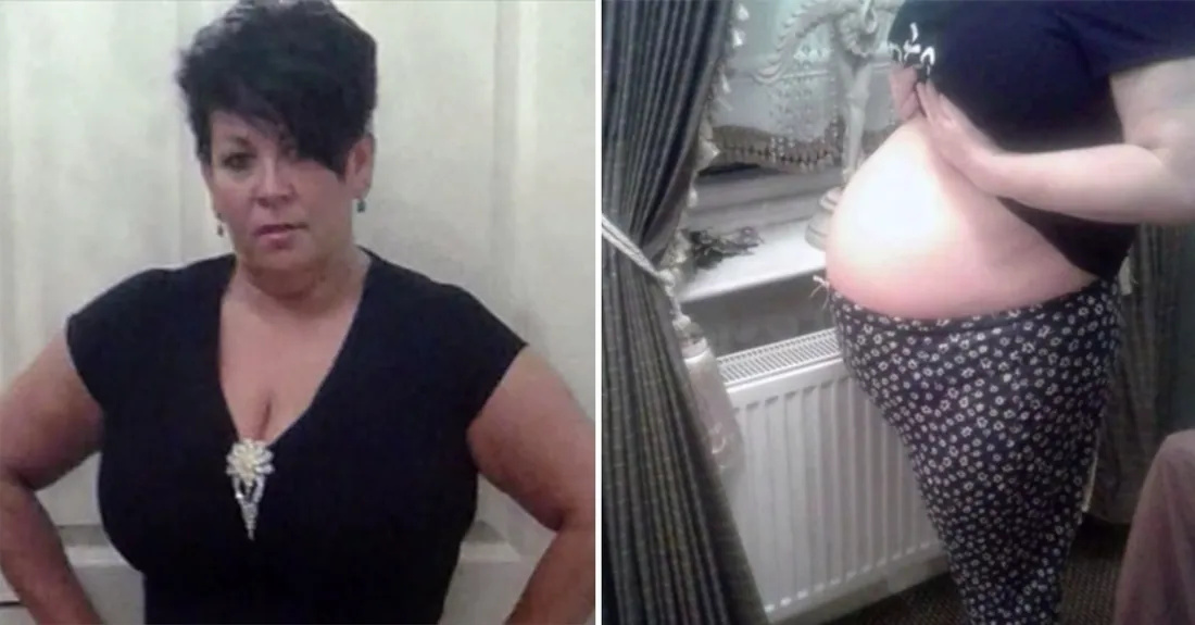 Cette femme est restée "enceinte" plus de 3 ans, ce qu'elle va découvrir est affreux 