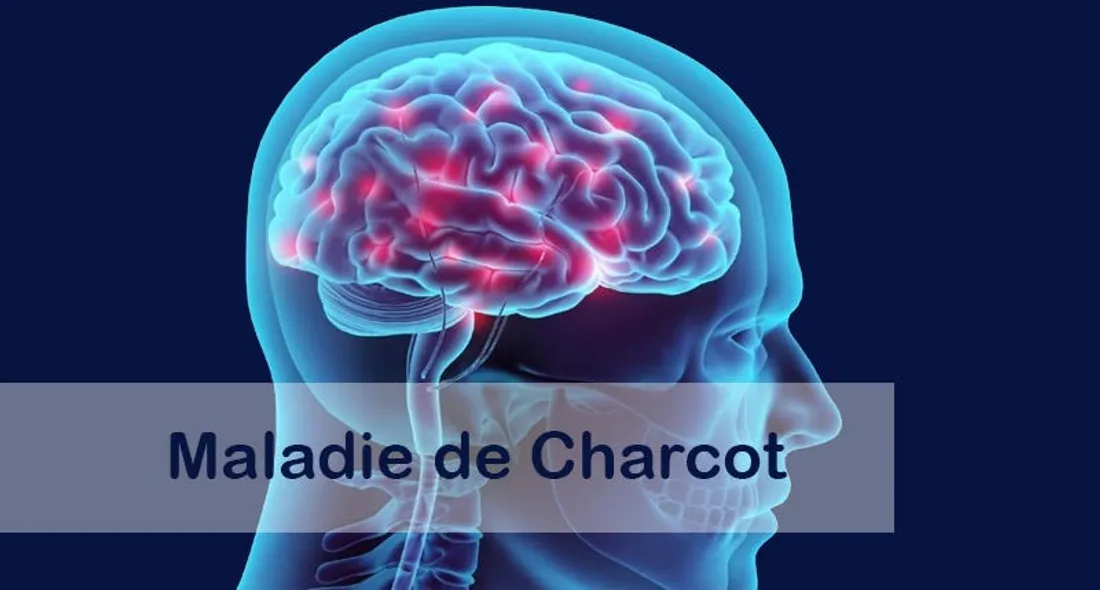 Et si les premiers signes de la maladie de Charcot étaient dans le sommeil ?