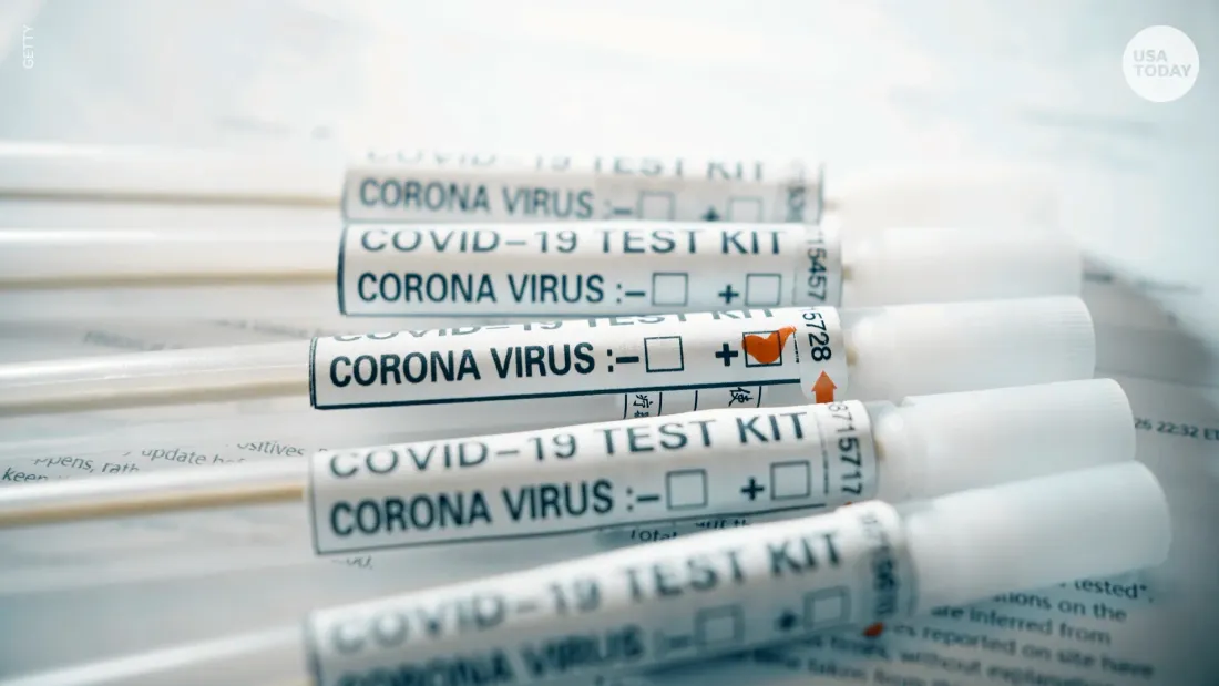 Une infirmière et son mari jugés pour une escroquerie présumée de 380 000 euros aux tests Covid