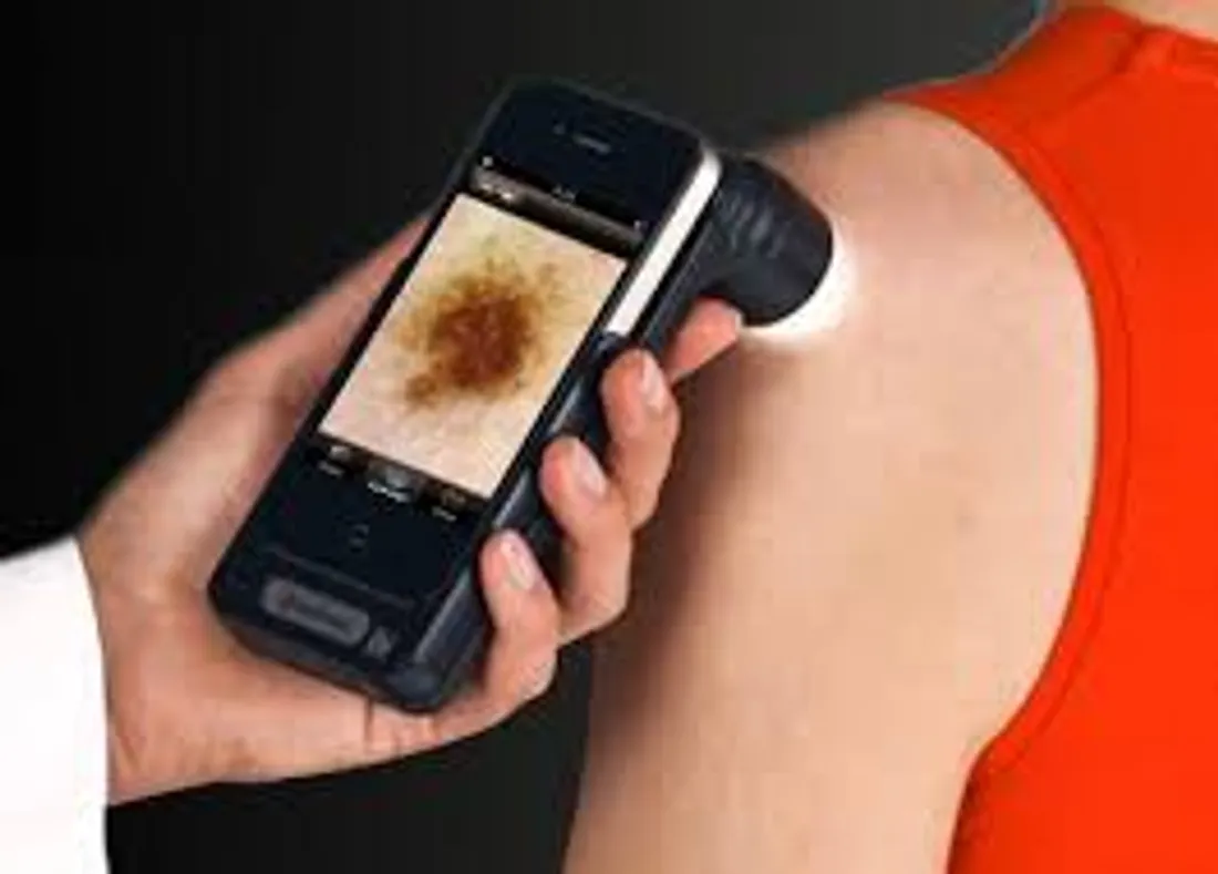 [ SANTE ] Les cancers de la peau sous surveillance dans le pays d'Arles