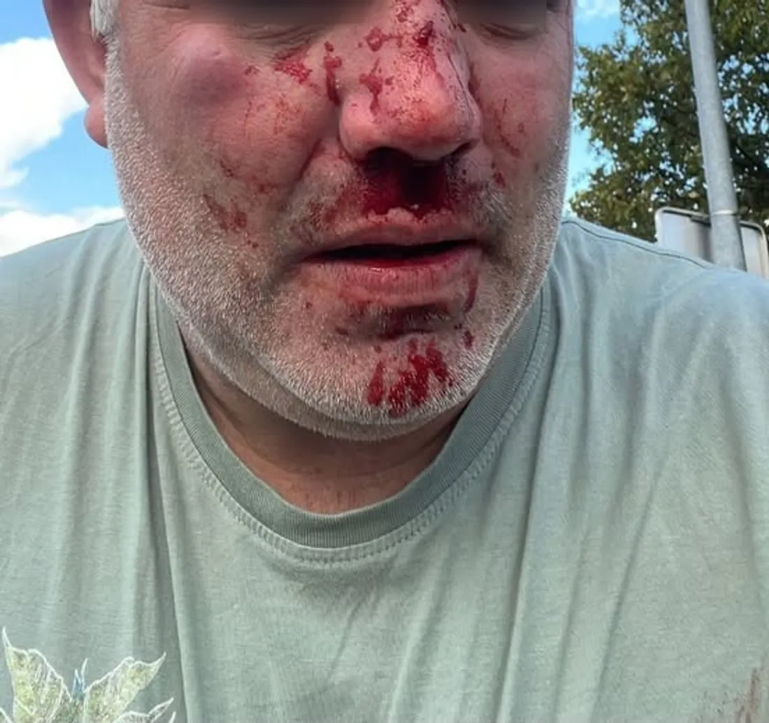 policier agressé Tourcoing