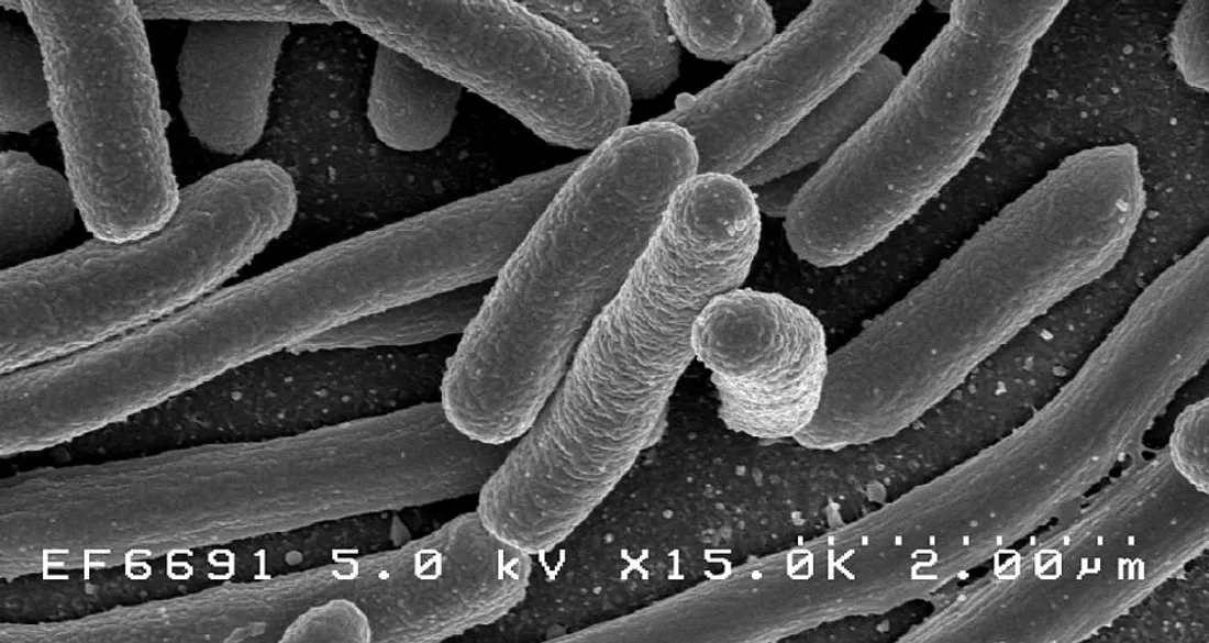 Bactéries E.Coli