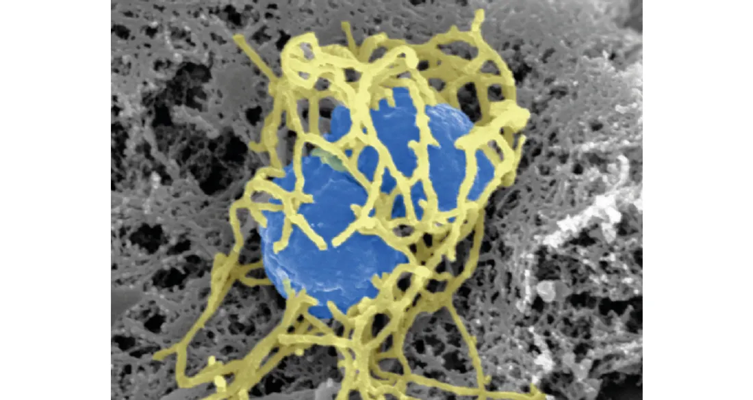 Bactérie Neisseria meningitidis