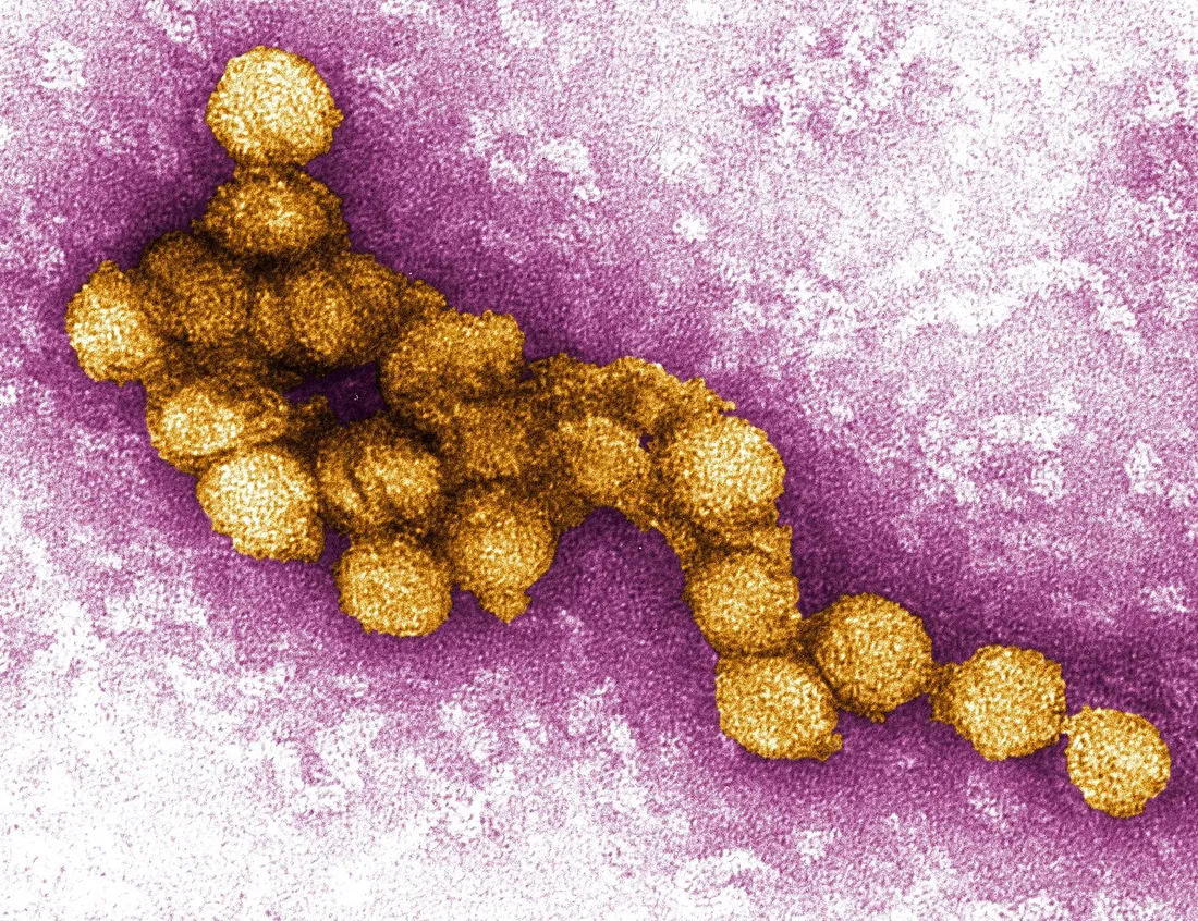 Virus du Nil occidental