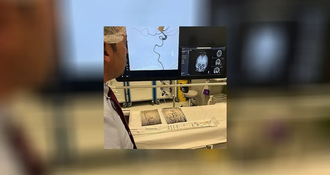 Neuroradiologie à Mantes-la-Jolie