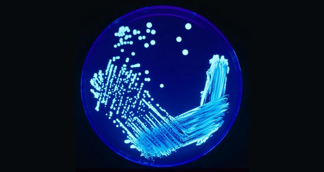 Culture de Legionelles en laboratoire