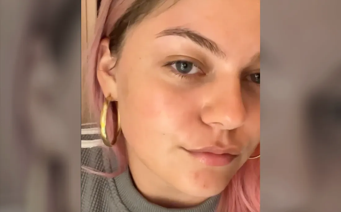 Louane pose devant son objectif, affichant son soin du visage