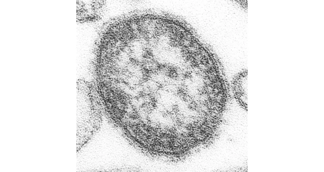 Virus de la rougeole vu au microscope