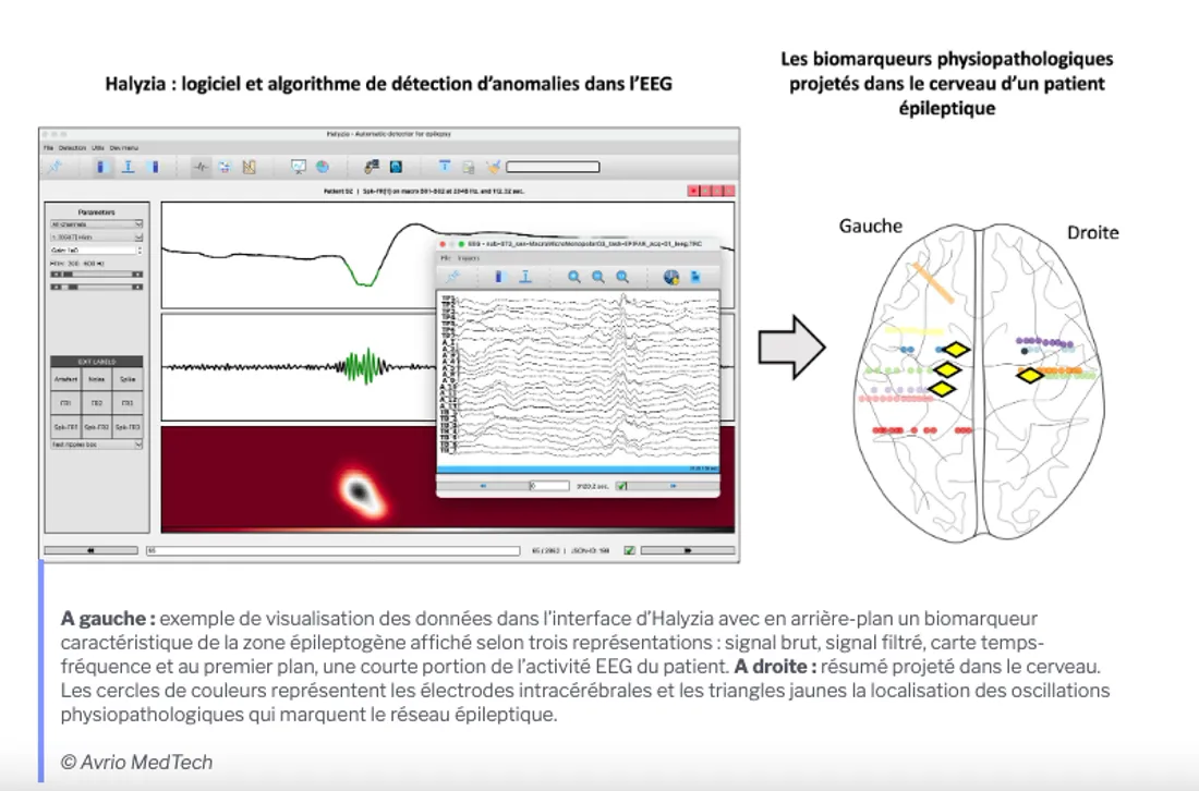 Exemple de visualisation des données dans l’interface d’Halyzia