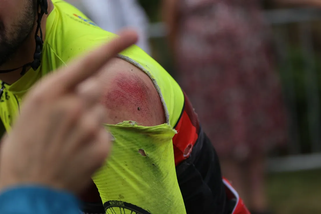 Une trentaine de coureur du peloton ont chuté ce dimanche à Pommerieux.