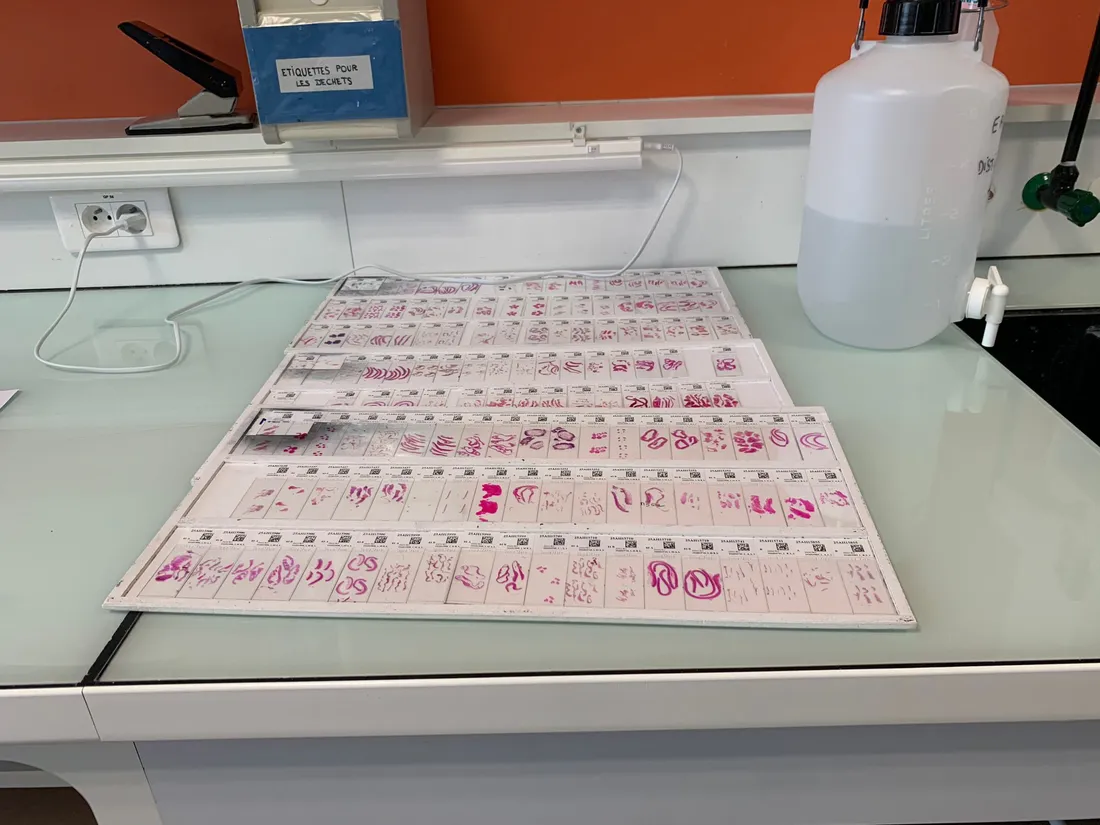 Plateau de lames CHU Angers_07 04 26_AVC