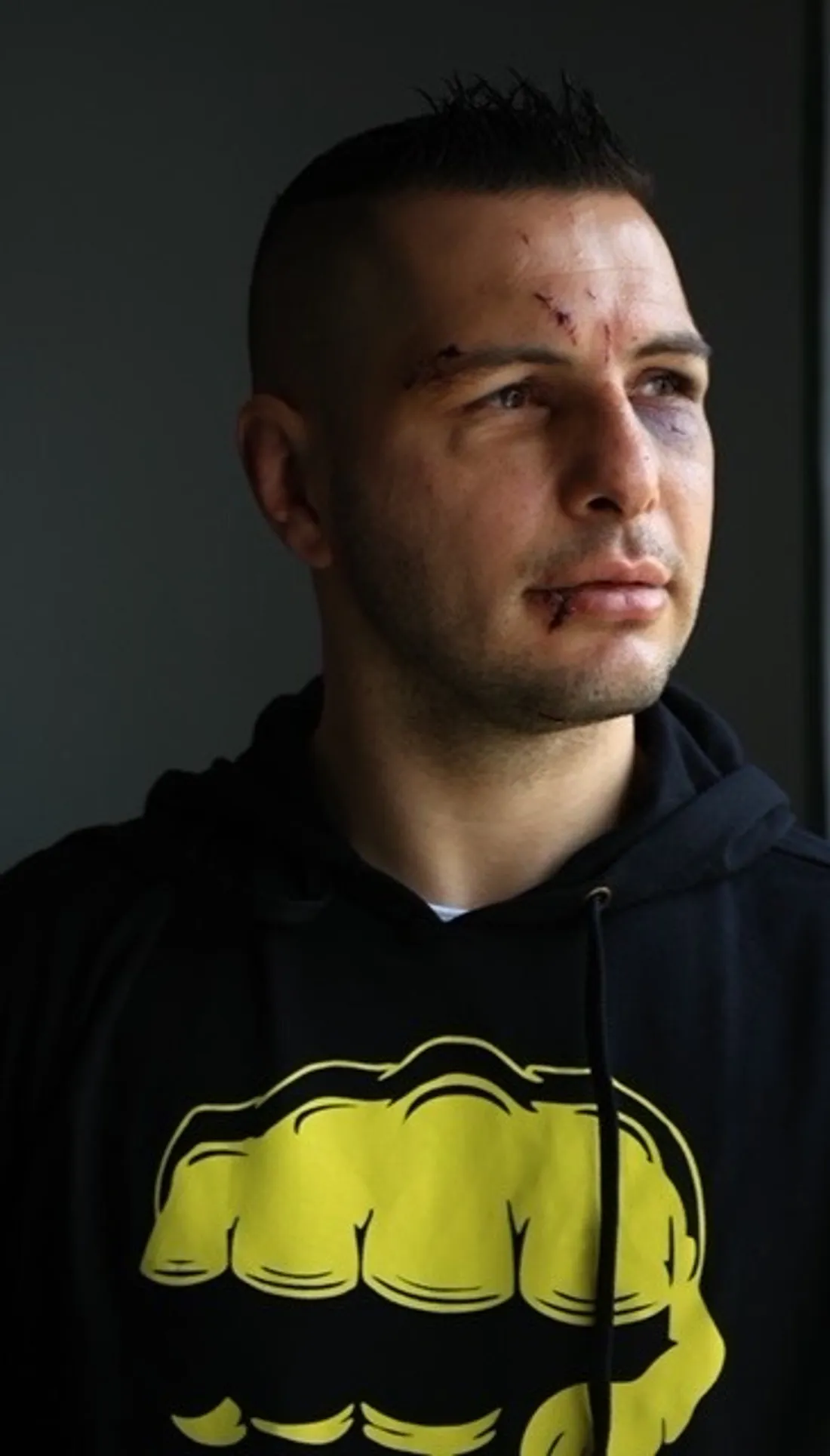 Cédric Séverac en a encore sous le pied.