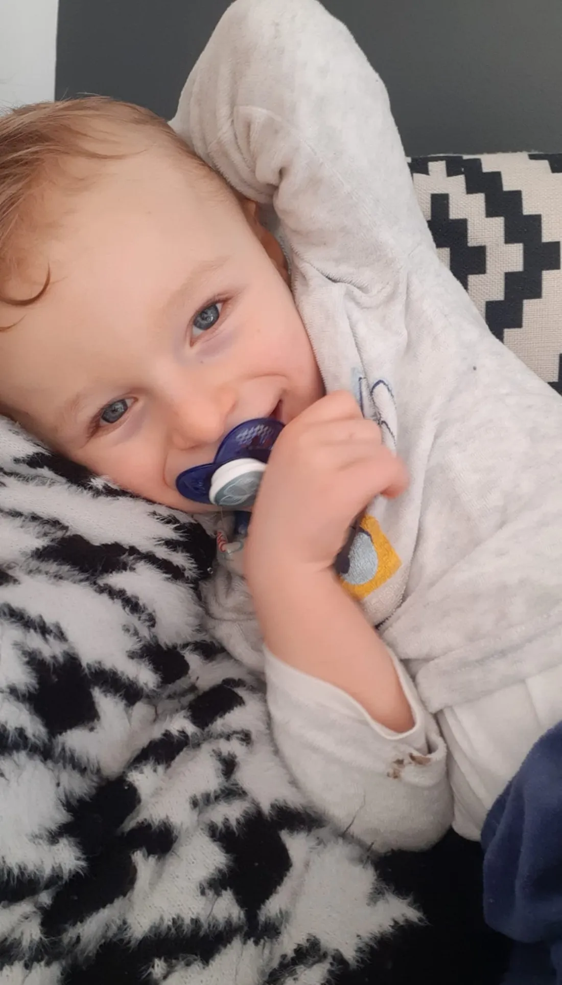 Nathan syndrome Angelman