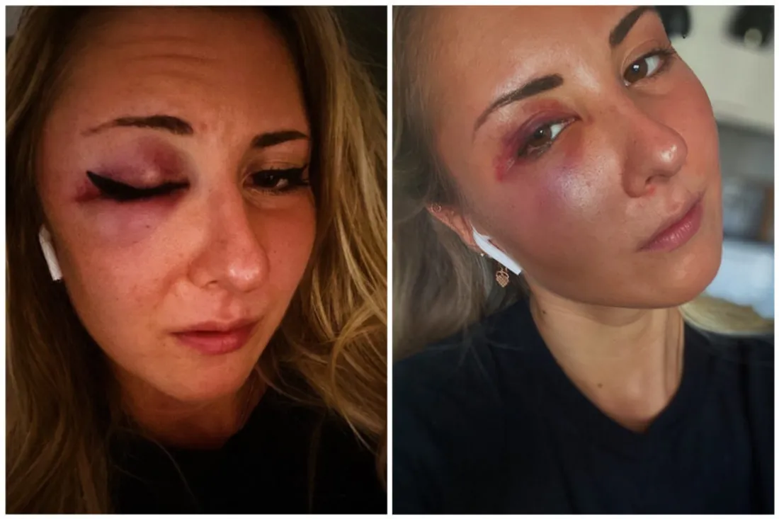 Agression Strasbourg jupe