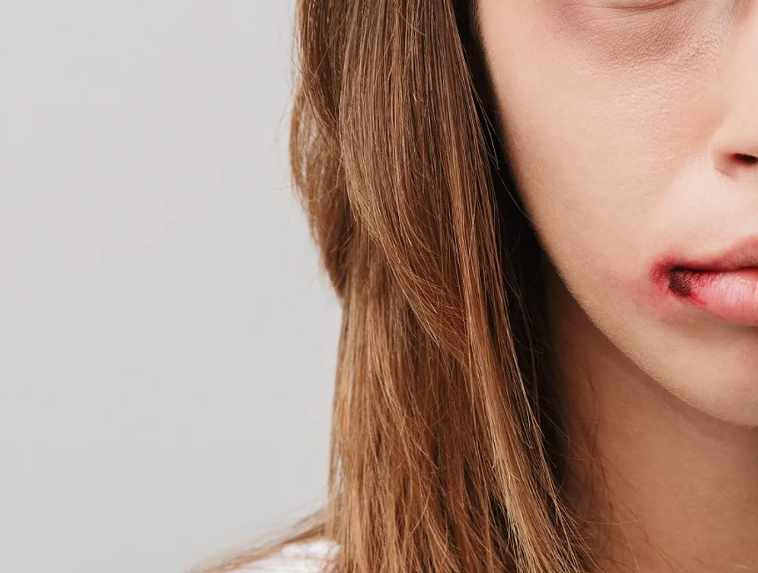 Violences faites aux femmes