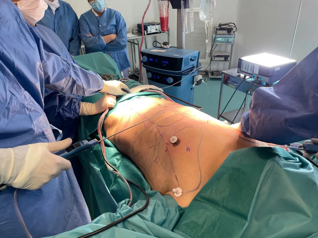 Suite de l'opération