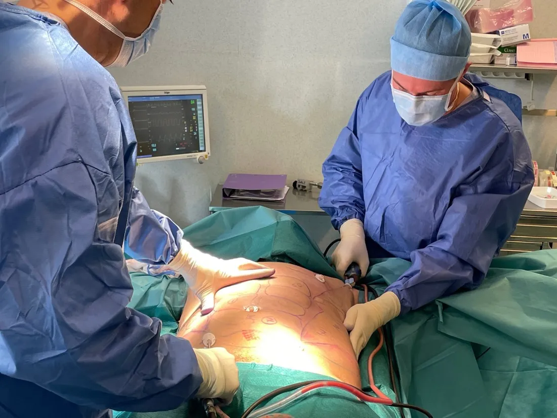 Début de l'opération