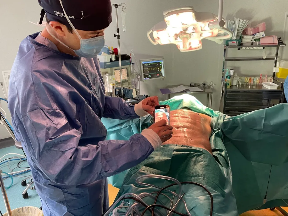 Un patient se fait "greffer" des abdos