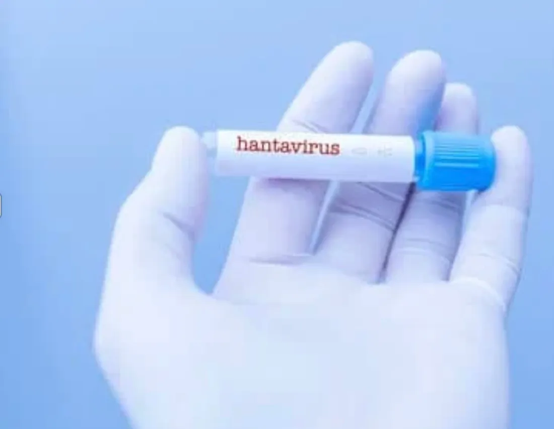 Hantavirus