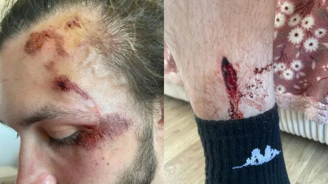 Appel à témoins à Boulogne-sur-Mer : Thomas, percuté violemment par...