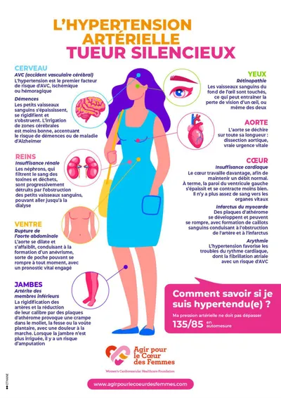  Hypertension Artérielle
