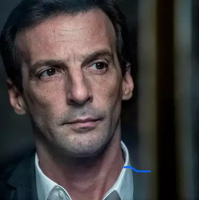 4/09/23 : Mathieu Kassovitz victime d’un grave accident de moto
