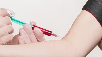 Bipolarité : un test sanguin comme diagnostic