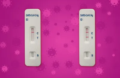 Hausse de l'épidémie de Covid-19 en France