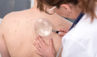 La pénurie de dermatologues continue de s’aggraver en France