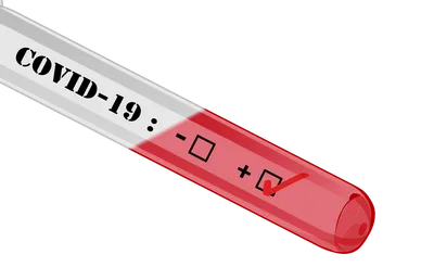 Légère hausse des contaminations au Covid-19 dans les Alpes-Maritimes