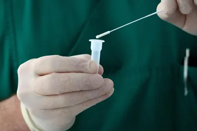 Hantavirus : la France active un dispositif sanitaire d’urgence