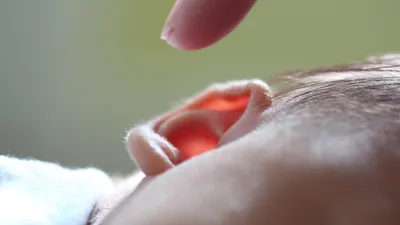 Ava, née sans oreilles, commence à entendre après une première...