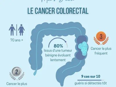 Le taux de dépistage du cancer colorectal toujours "dérisoire",...