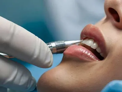 Lamorlaye : un dentiste interdit d'exercer pour six mois