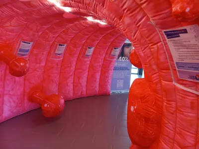Segré. Un côlon géant gonflable pour inciter au dépistage du cancer