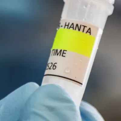 Hantavirus : la Française hospitalisée a la forme "la plus sévère"...