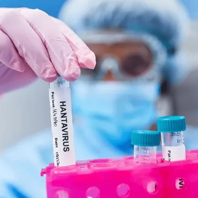 SONDAGE ALOUETTE : l'hantavirus vous inquiète-t-il ?