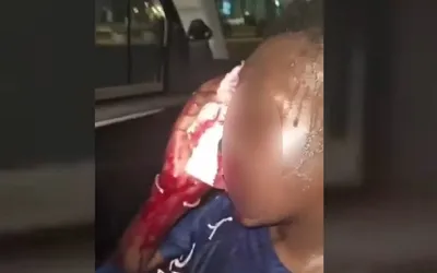 Bobigny : un adolescent de 13 ans perd son œil lors des fêtes du PSG
