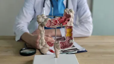 Saucisses : le lien inquiétant avec le cancer du côlon révélé par...