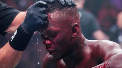 Israel Adesanya réagit après sa défaite au TKO face à Joe Pyfer